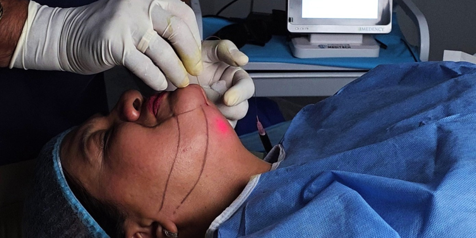 Dr Ajay Rana explains how Endolift is changing non surgical skin tightening